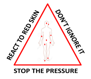 Tissue Viability and Lymphoedema Service - Pressure Ulcers